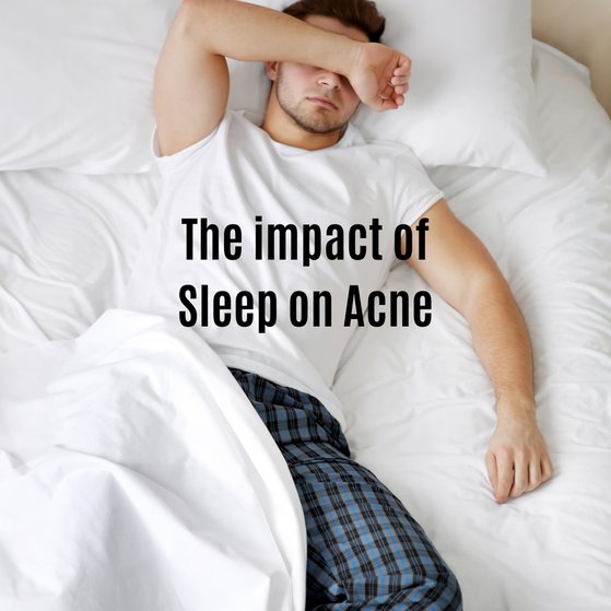 Impact of Sleep on Acne