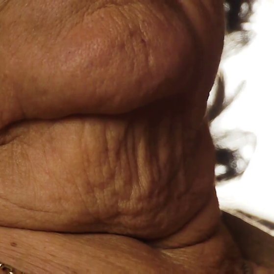 ageing-neck