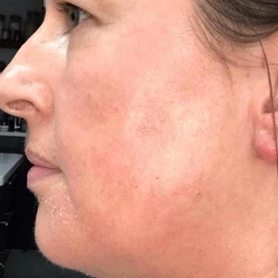 Cosmelan 2 after crop dinfs0v