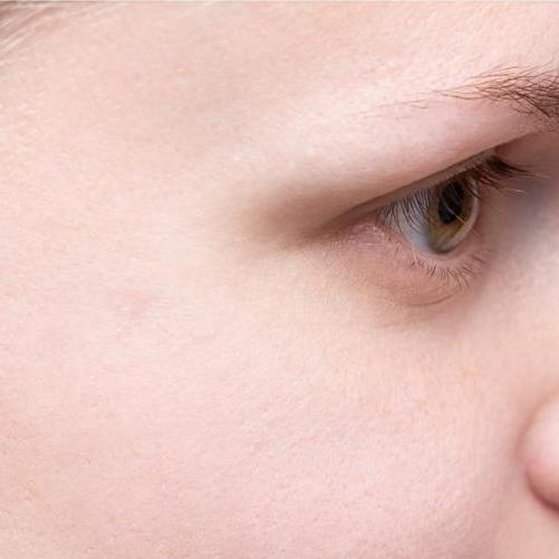 Wart and Verruca Removal 3 wart removal after