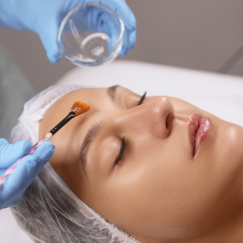Chemical Peel at The Skin Investment Clinic
