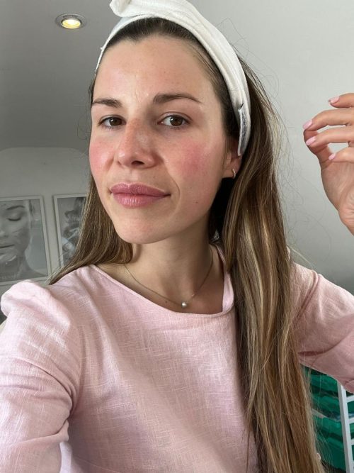 Bespoke Luxury Facial 4 Bespoke Facial At The Skin Investment Clinic