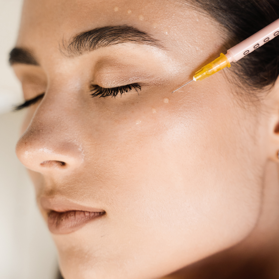 Mesotherapy at The Skin Investment Clinic