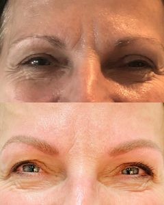 PMU Eyebrows 4 photo 2025 03 10 12 00 29