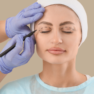 Upper blepharoplasty